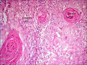 Mamalis Eyelid 57 labeled