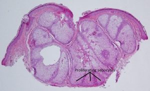 Mamalis Eyelid 59 labeled