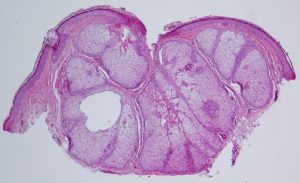 Mamalis Eyelid 59 unlabeled