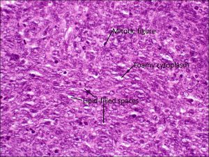 Mamalis Eyelid 62 labeled