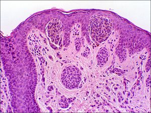 Mamalis Eyelid 66 unlabeled