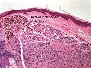 Mamalis Eyelid 67 labeled