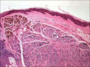 Mamalis Eyelid 67 unlabeled