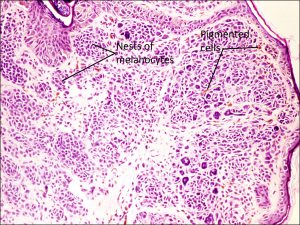 Mamalis Eyelid 69 labeled