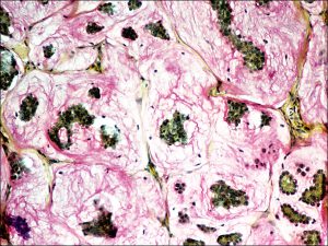 Mamalis Eyelid 76 unlabeled