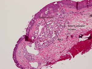 Mamalis Eyelid 78 labeled