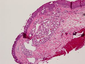 Mamalis Eyelid 78 unlabeled