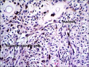 Mamalis Tumor 03 labeled