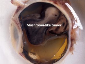 Mamalis Tumor 14 labeled