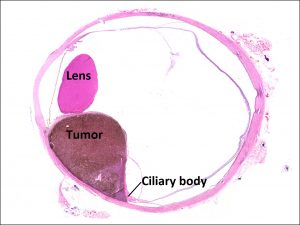 Mamalis Tumor 15 labeled