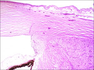 Mamalis Tumor 16 unlabeled