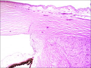 Mamalis Tumor 16 unlabeled