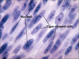 Mamalis Tumor 19 labeled