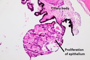 Mamalis Tumor 22 labeled