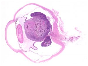 Mamalis Tumor 28 unlabeled