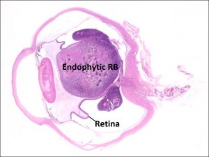 Mamalis Tumor 28 labeled