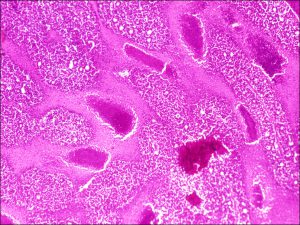 Mamalis Tumor 30 unlabeled