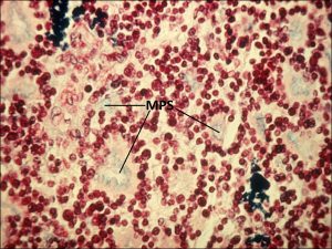 Mamalis Tumor 32 labeled