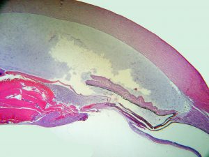 Mamalis Tumor 45 unlabeled