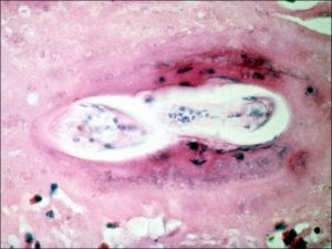 Mamalis Tumor 47 unlabeled