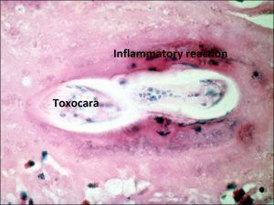 Mamalis Tumor 47 labeled