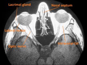 Mamalis Normal Eye 03