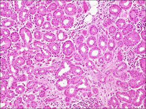 Mamalis Normal Eye 04