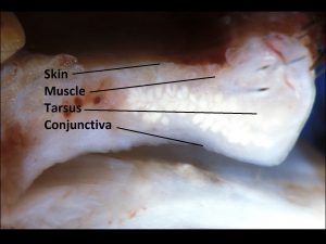 Mamalis Normal Eye 05