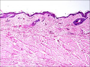 Mamalis Normal Eye 07