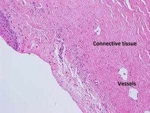 Mamalis Normal Eye 13