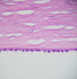 Mamalis Normal Eye 16
