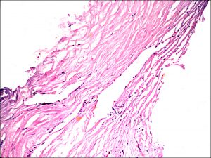 Mamalis Normal Eye 18