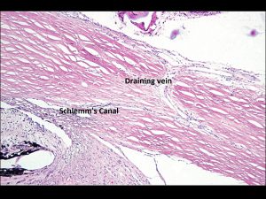 Mamalis Normal Eye 20