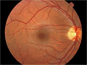 Mamalis Normal Eye 38