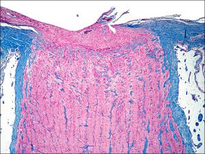 Mamalis Normal Eye 43