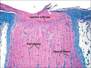 Mamalis Normal Eye 43