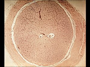 Mamalis Normal Eye 44