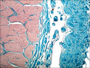 Mamalis Normal Eye 45