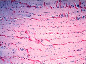 Mamalis Normal Eye46