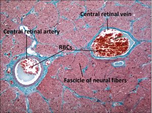 Mamalis Normal Eye 47