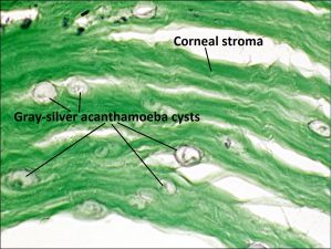 Mamalis Normal Eye 50