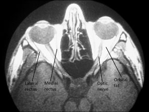 Mamalis Orbit 03 labeled