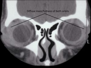 Mamalis Orbit 06 labeled