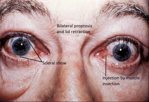 Mamalis Orbit 17 labeled