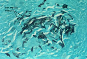 Mamalis Orbit 21 labeled