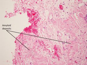 Mamalis Orbit 23 labeled
