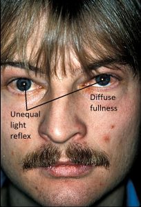 Mamalis Orbit 25 labeled