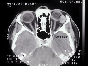 Mamalis Orbit 30 labeled