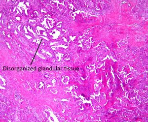 Mamalis Orbit 33 labeled