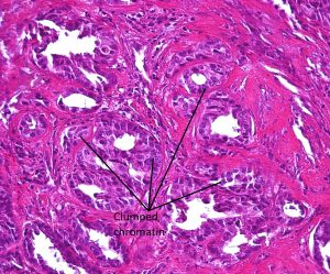 Mamalis Orbit 34 labeled